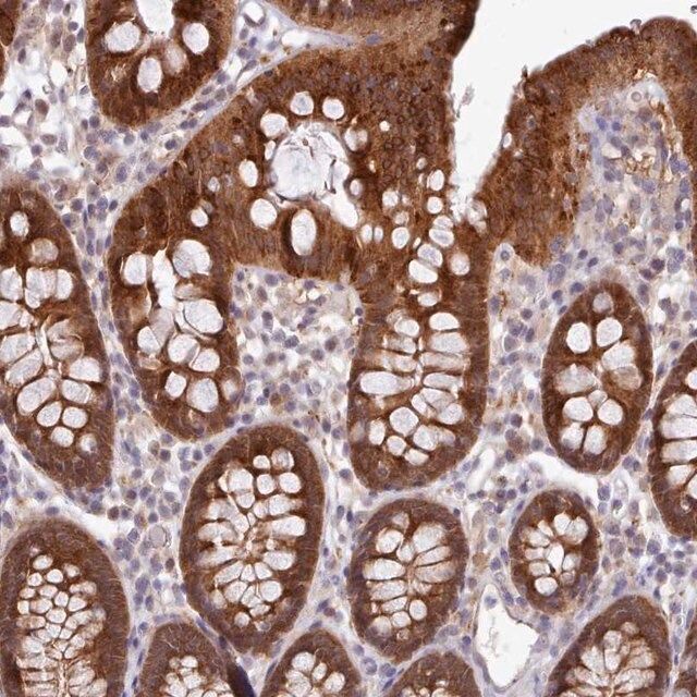 Anti-CES3 antibody produced in rabbit