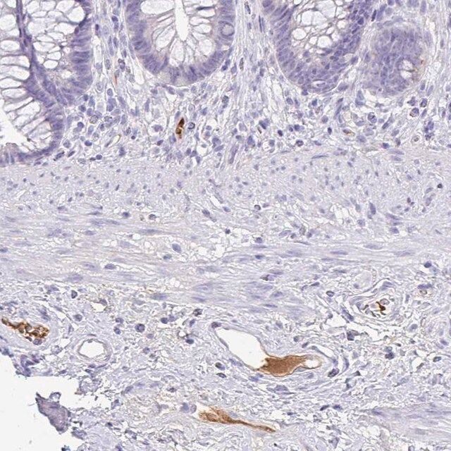 Anti-CFH antibody produced in rabbit