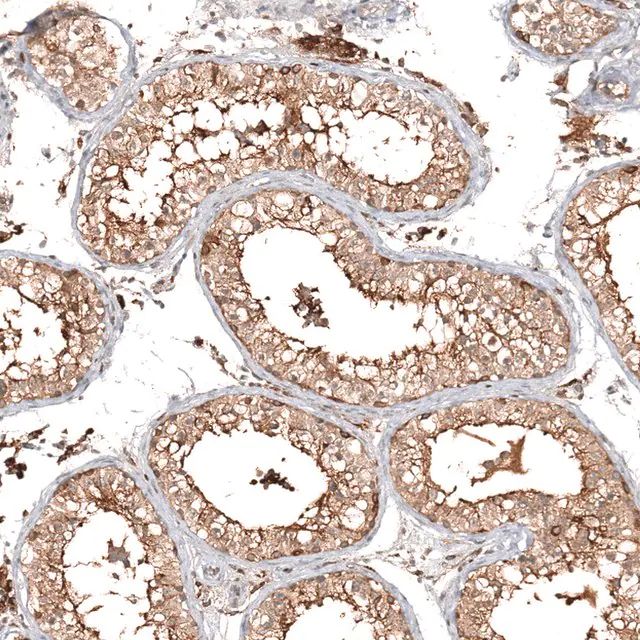 Anti-CFAP46 antibody produced in rabbit