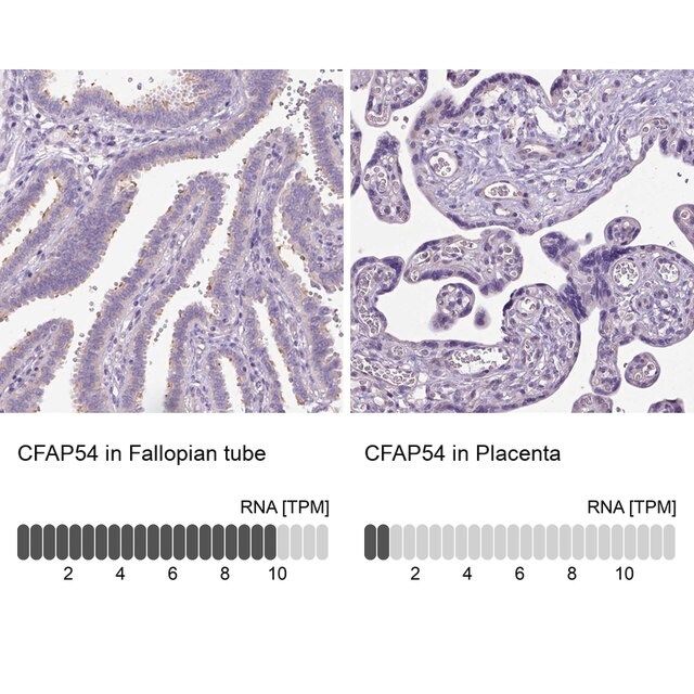 Anti-CFAP54 antibody produced in rabbit