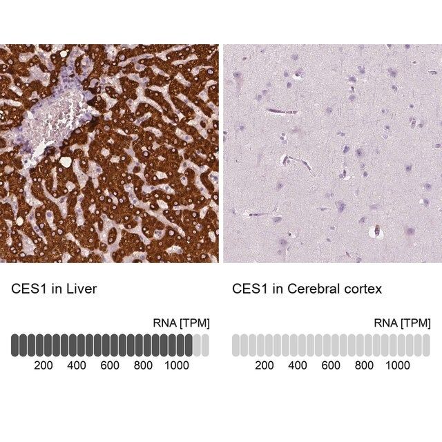 Anti-CES1 antibody produced in rabbit