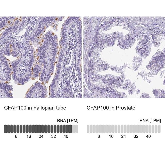 Anti-CFAP100 antibody produced in rabbit