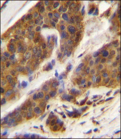 ANTI-CFD (N-TERM) antibody produced in rabbit