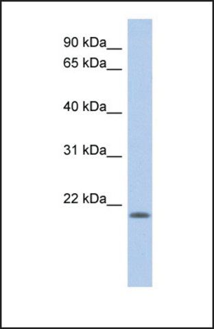 Anti-CHAC2, (N-terminal) antibody produced in rabbit