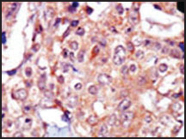 Anti-CHAK1 (N-term) antibody produced in rabbit