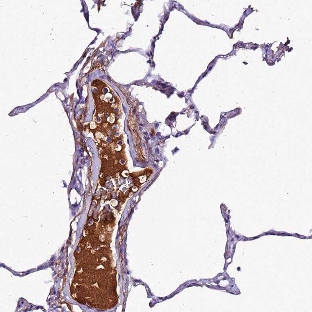 Anti-CFHR1 antibody produced in rabbit