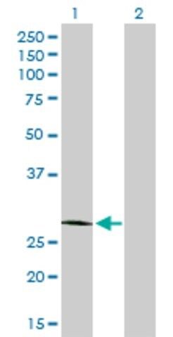 Anti-CFHR2 antibody produced in rabbit