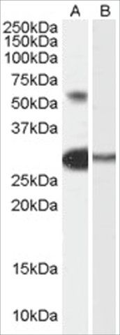 Anti-CHA/TCFL5 antibody produced in goat