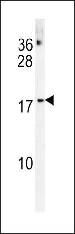 ANTI-CHCHD2 (CENTER) antibody produced in rabbit