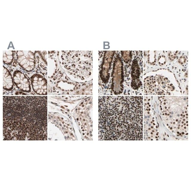 Anti-CHAMP1 antibody produced in rabbit