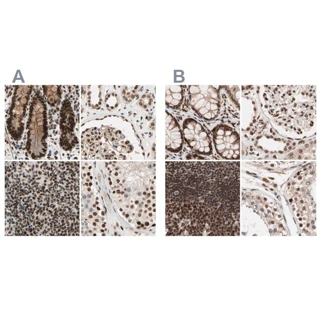 Anti-CHAMP1 antibody produced in rabbit