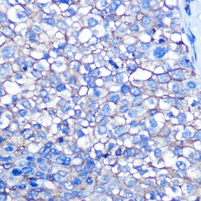 Anti-CD13/ANPEP antibody produced in rabbit