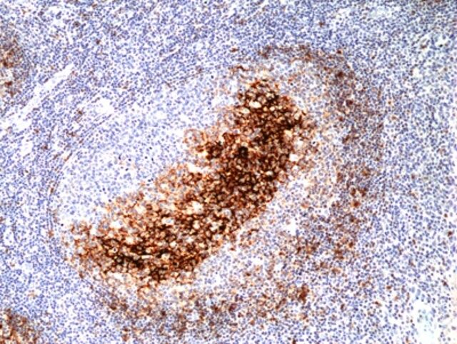 Anti-CD23(FcER-II) Rabbit Monoclonal Antibody