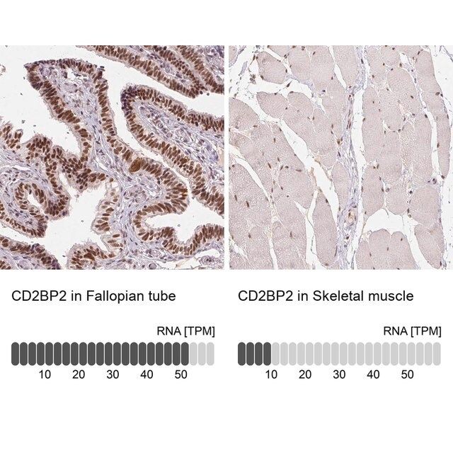 Anti-CD2BP2 antibody produced in rabbit