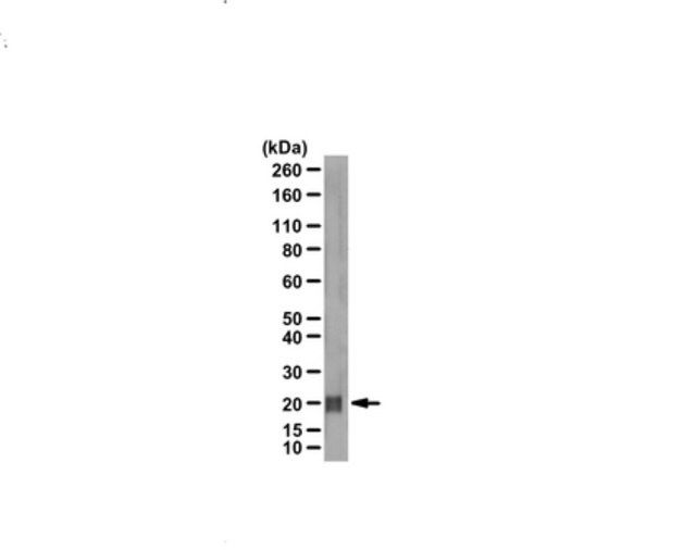 Anti-CDC42 Antibody, Brain Isoform-specific