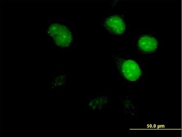 Anti-CDCA8 antibody produced in mouse