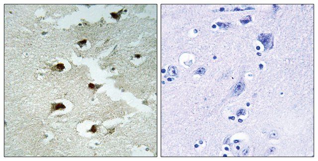 Anti-CDCA4 antibody produced in rabbit