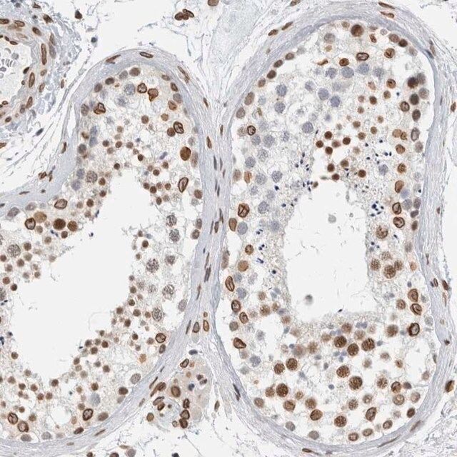 Anti-CDCA2 antibody produced in rabbit