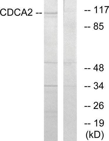 Anti-CDCA2 antibody produced in rabbit