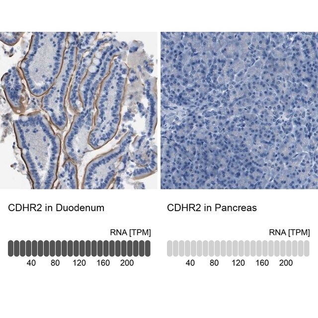 Anti-CDHR2 antibody produced in rabbit