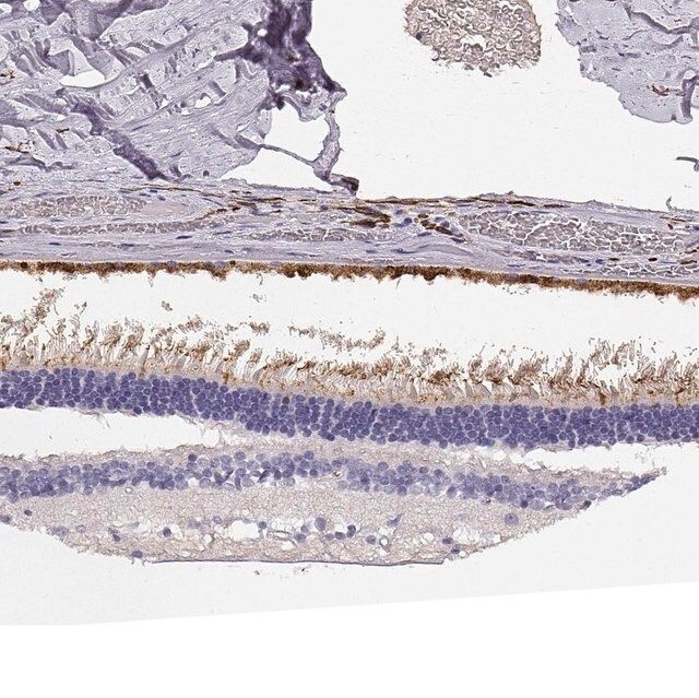 Anti-CDHR1 antibody produced in rabbit