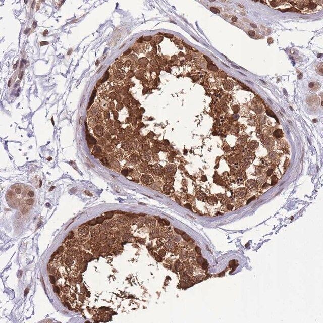 Anti-CDIP1 antibody produced in rabbit