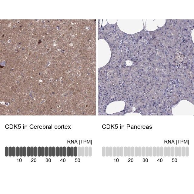 Anti-CDK5 antibody produced in rabbit