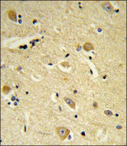 ANTI-CDIPT (CENTER) antibody produced in rabbit