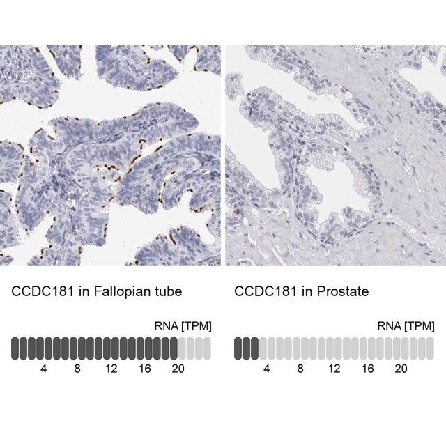 Anti-CCDC181 antibody produced in rabbit