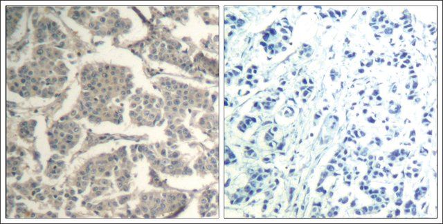 Anti-CCFL1/CFL2 (Ab-88) antibody produced in rabbit