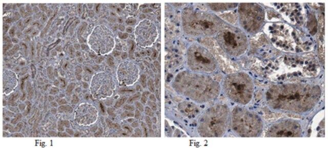 Anti-CCN1/CYR61 Antibody