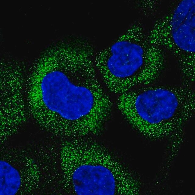 Anti-CCHCR1 antibody produced in rabbit