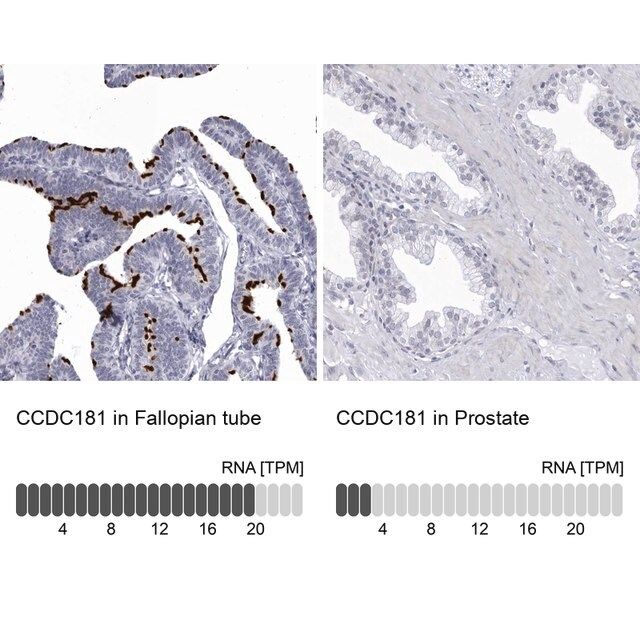 Anti-CCDC181 antibody produced in rabbit