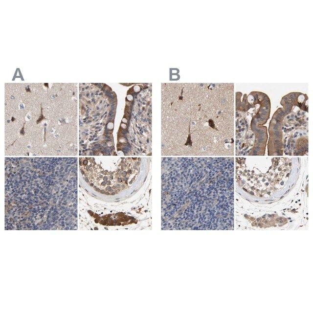 Anti-CCDC155 antibody produced in rabbit