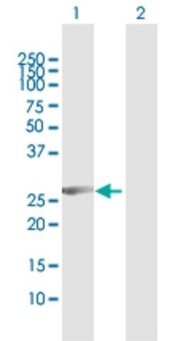 Anti-CCNB1IP1 antibody produced in rabbit