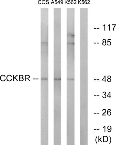 Anti-CCKBR antibody produced in rabbit