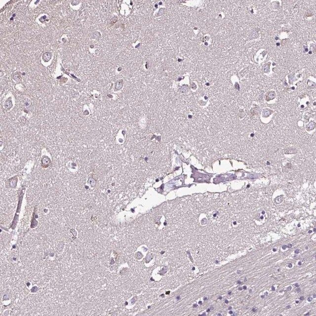 Anti-CCDC85C antibody produced in rabbit