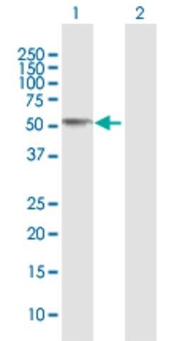 Anti-CCM2 antibody produced in rabbit