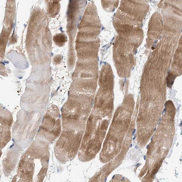 Anti-CCDC171 antibody produced in rabbit