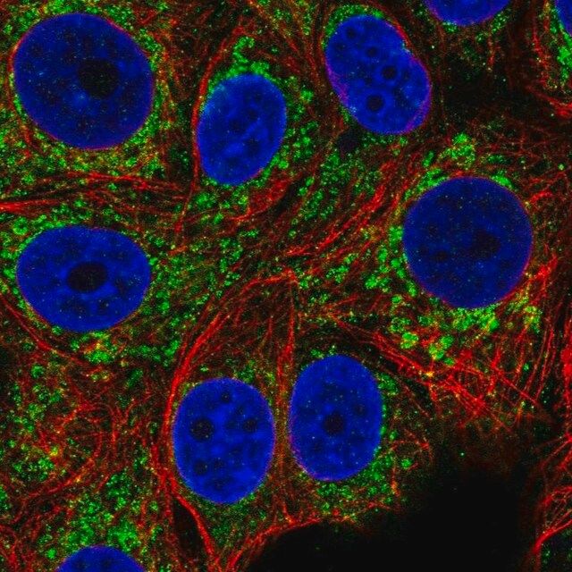 Anti-CCM2 antibody produced in rabbit