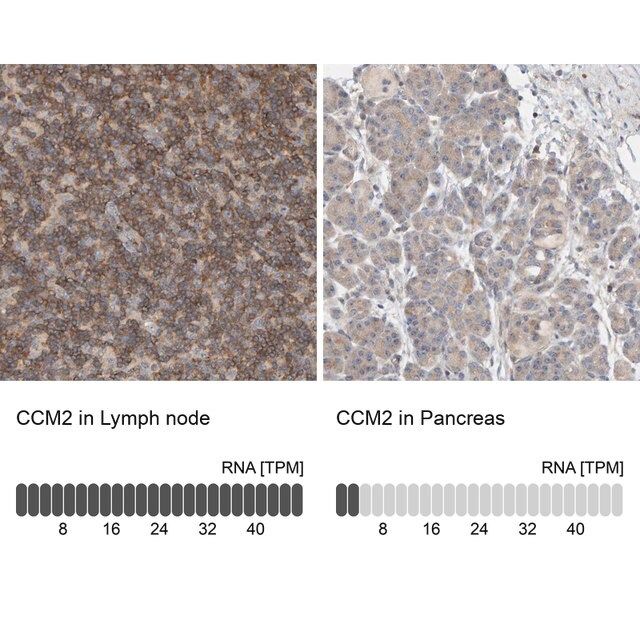 Anti-CCM2 antibody produced in rabbit