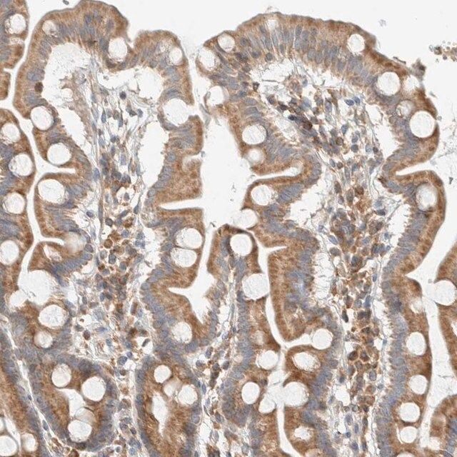 Anti-CCDC57 antibody produced in rabbit