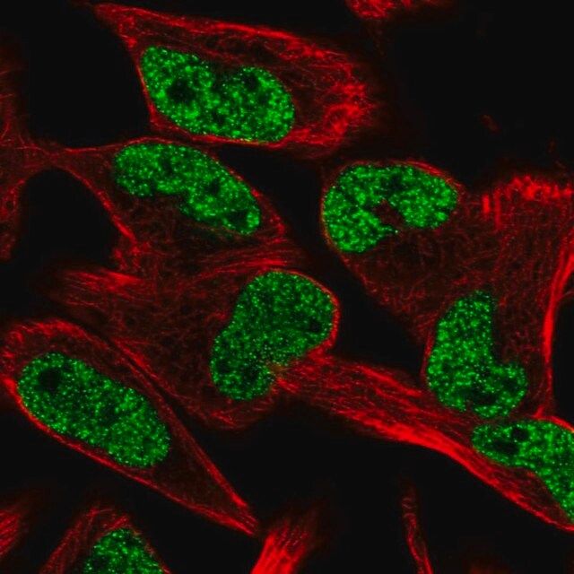 Anti-CCM2L antibody produced in rabbit