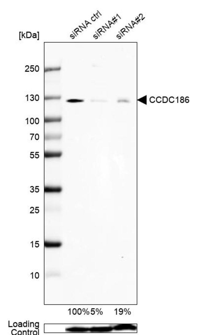 Anti-CCDC186 antibody produced in rabbit