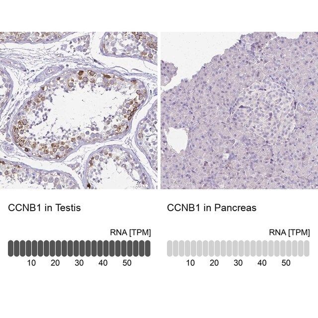 Anti-CCNB1 antibody produced in rabbit