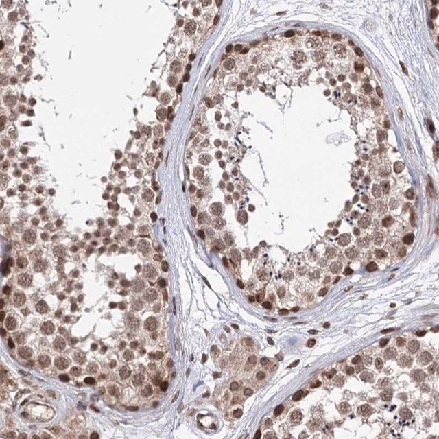 Anti-CCDC77 antibody produced in rabbit