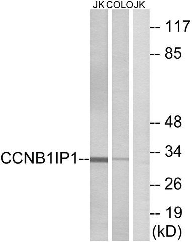 Anti-CCNB1IP1 antibody produced in rabbit