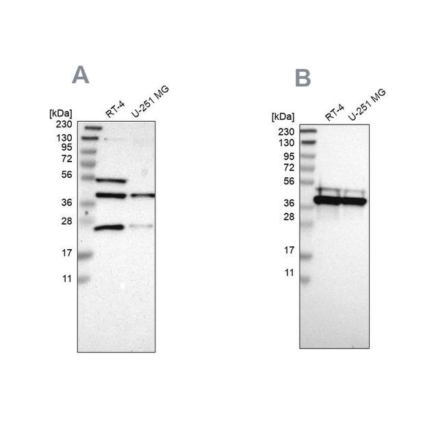 Anti-CCDC51 antibody produced in rabbit