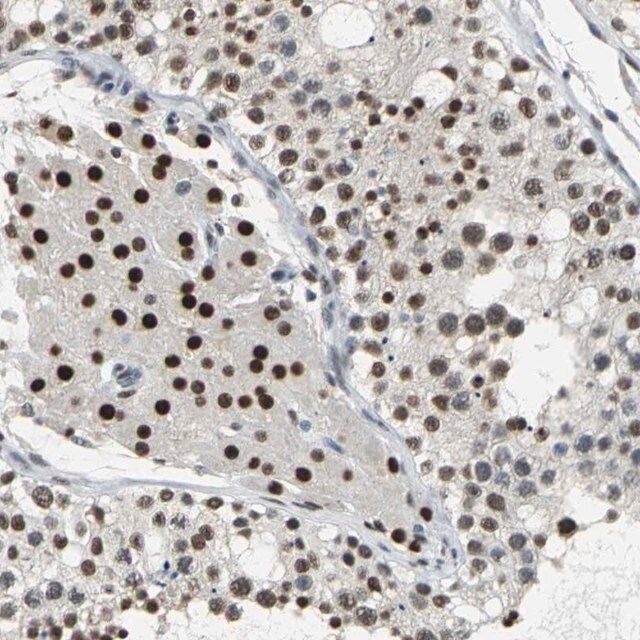 Anti-CCDC88C antibody produced in rabbit