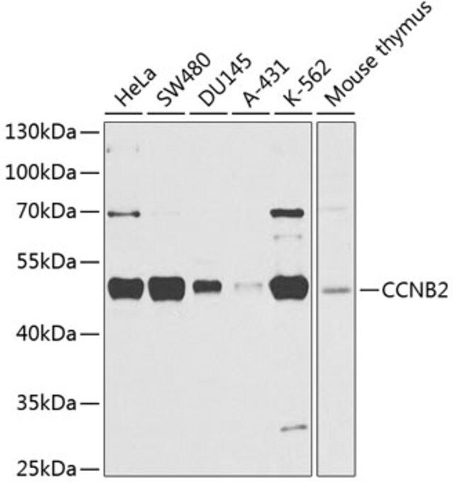 Anti-CCNB2 antibody produced in rabbit